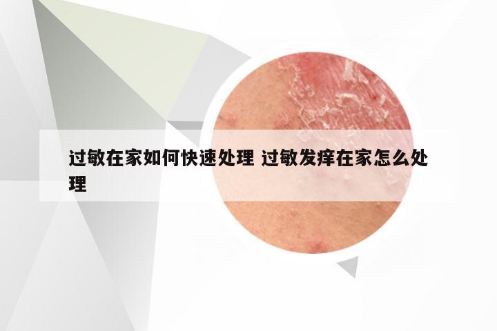 过敏在家如何快速处理 过敏发痒在家怎么处理