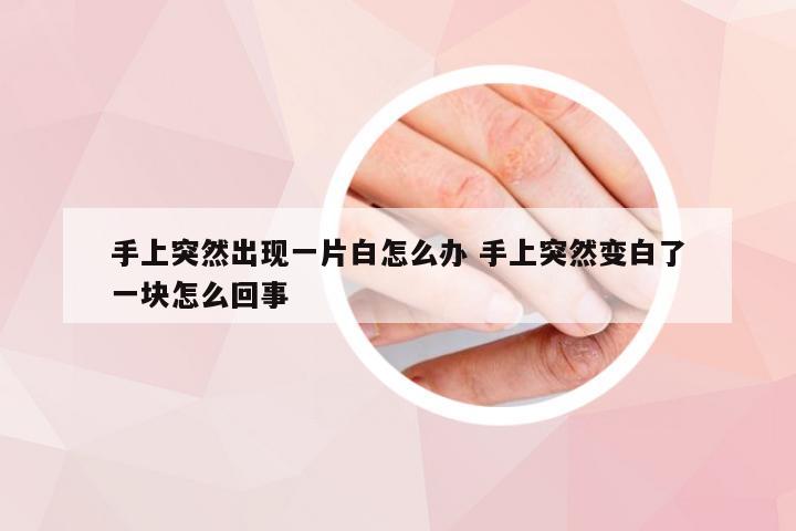 手上突然出现一片白怎么办 手上突然变白了一块怎么回事
