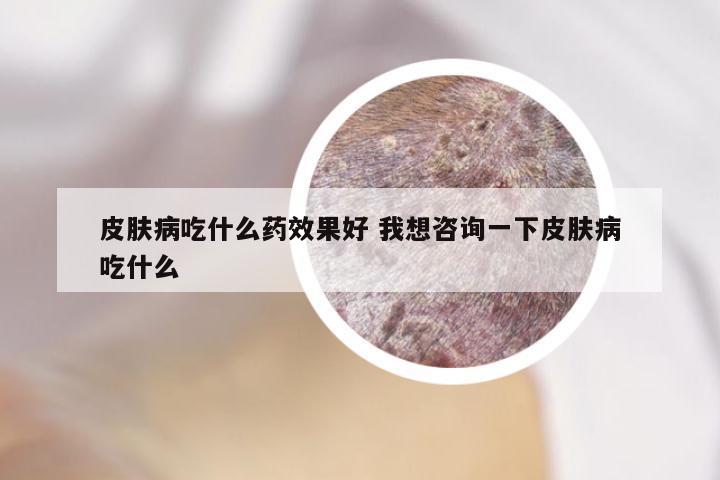 皮肤病吃什么药效果好 我想咨询一下皮肤病吃什么