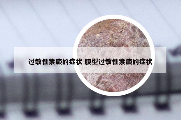 过敏性紫癜的症状 腹型过敏性紫癜的症状