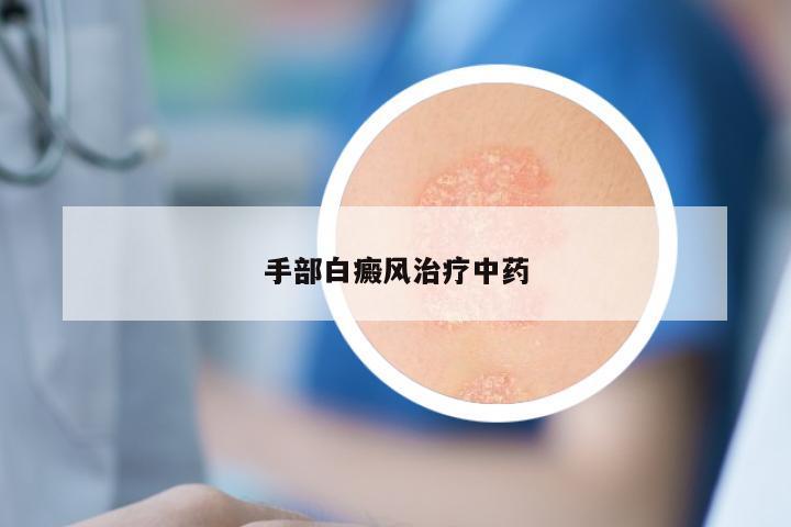 手部白癜风治疗中药