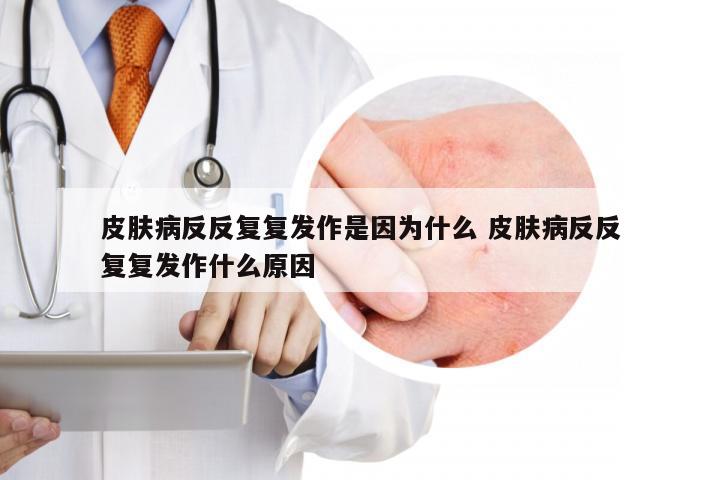 皮肤病反反复复发作是因为什么 皮肤病反反复复发作什么原因