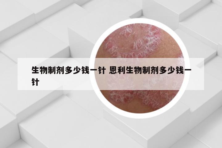 生物制剂多少钱一针 恩利生物制剂多少钱一针
