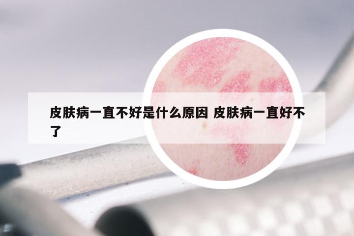 皮肤病一直不好是什么原因 皮肤病一直好不了