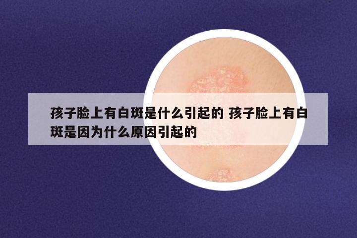 孩子脸上有白斑是什么引起的 孩子脸上有白斑是因为什么原因引起的