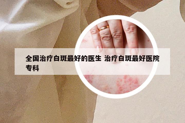 全国治疗白斑最好的医生 治疗白斑最好医院专科