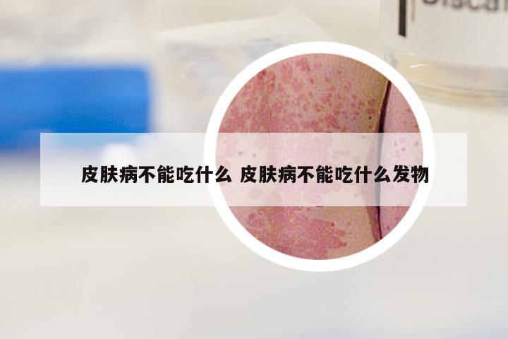 皮肤病不能吃什么 皮肤病不能吃什么发物
