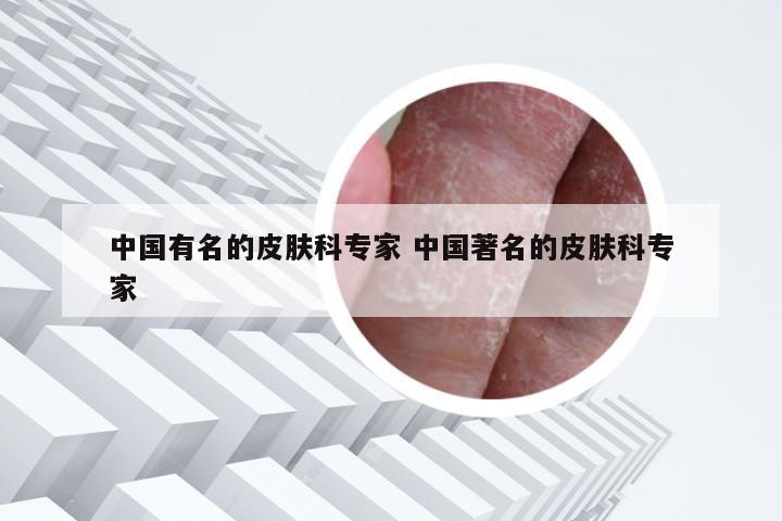 中国有名的皮肤科专家 中国著名的皮肤科专家