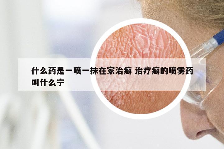 什么药是一喷一抹在家治癣 治疗癣的喷雾药叫什么宁
