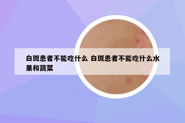 白斑患者不能吃什么 白斑患者不能吃什么水果和蔬菜