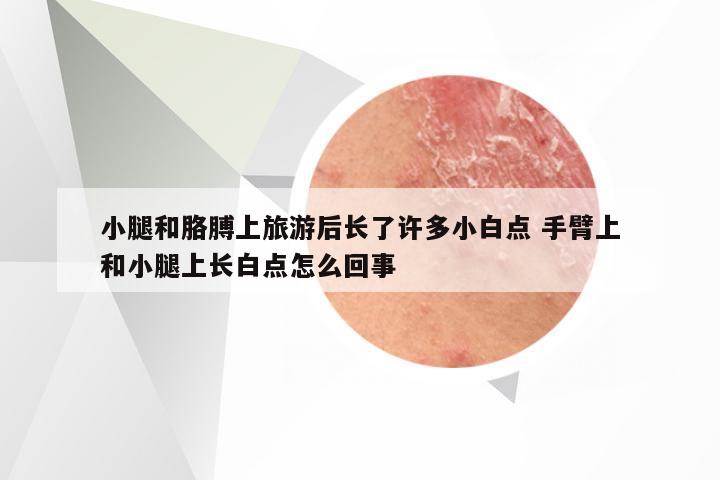 小腿和胳膊上旅游后长了许多小白点 手臂上和小腿上长白点怎么回事