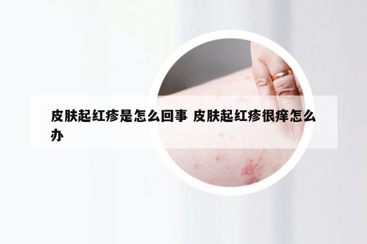 皮肤起红疹是怎么回事 皮肤起红疹很痒怎么办