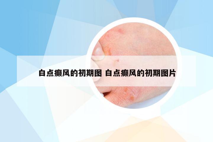 白点癫风的初期图 白点癫风的初期图片