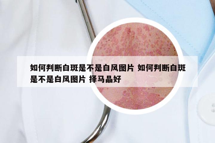 如何判断白斑是不是白风图片 如何判断白斑是不是白风图片 择马晶好