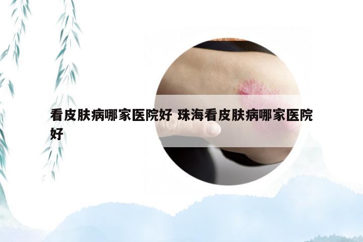 看皮肤病哪家医院好 珠海看皮肤病哪家医院好