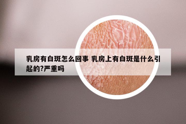 乳房有白斑怎么回事 乳房上有白斑是什么引起的?严重吗