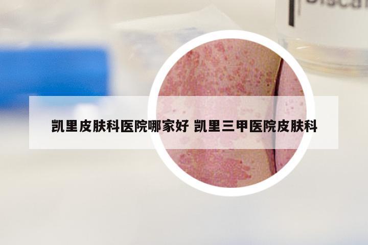 凯里皮肤科医院哪家好 凯里三甲医院皮肤科