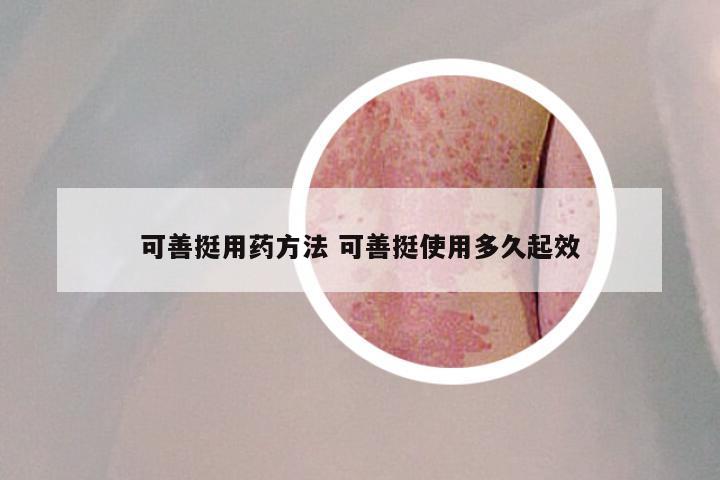 可善挺用药方法 可善挺使用多久起效