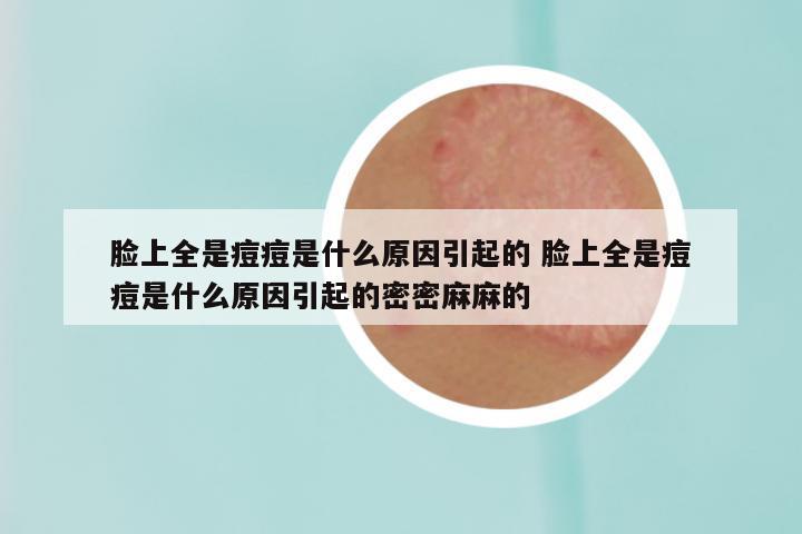 脸上全是痘痘是什么原因引起的 脸上全是痘痘是什么原因引起的密密麻麻的
