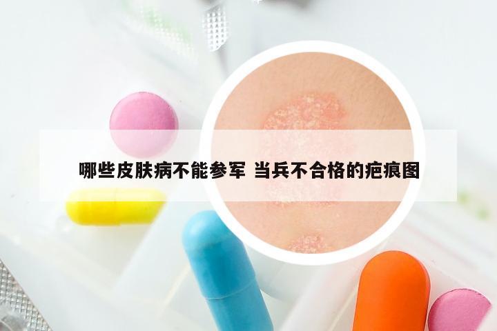 哪些皮肤病不能参军 当兵不合格的疤痕图