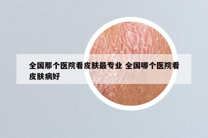全国那个医院看皮肤最专业 全国哪个医院看皮肤病好