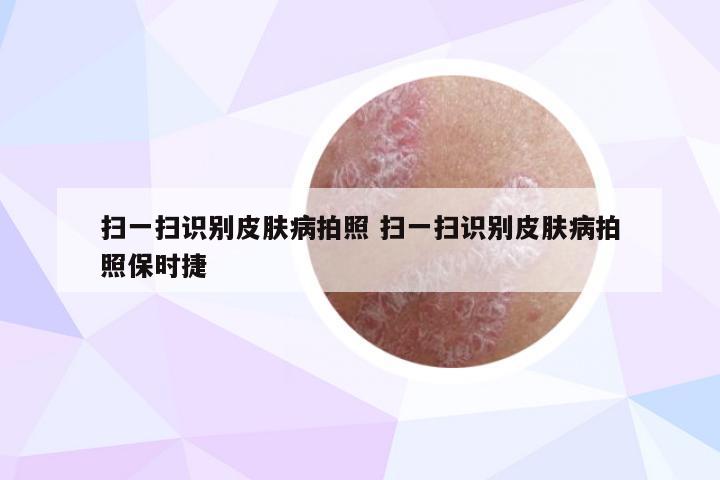 扫一扫识别皮肤病拍照 扫一扫识别皮肤病拍照保时捷