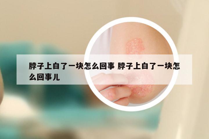 脖子上白了一块怎么回事 脖子上白了一块怎么回事儿