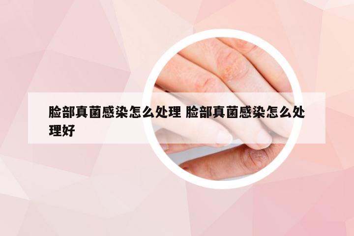 脸部真菌感染怎么处理 脸部真菌感染怎么处理好