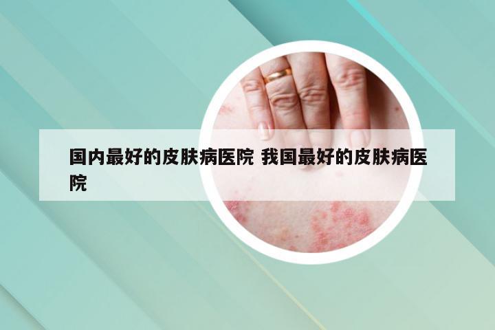 国内最好的皮肤病医院 我国最好的皮肤病医院