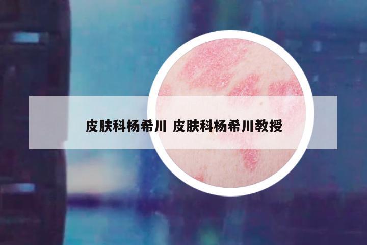 皮肤科杨希川 皮肤科杨希川教授