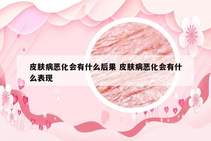 皮肤病恶化会有什么后果 皮肤病恶化会有什么表现