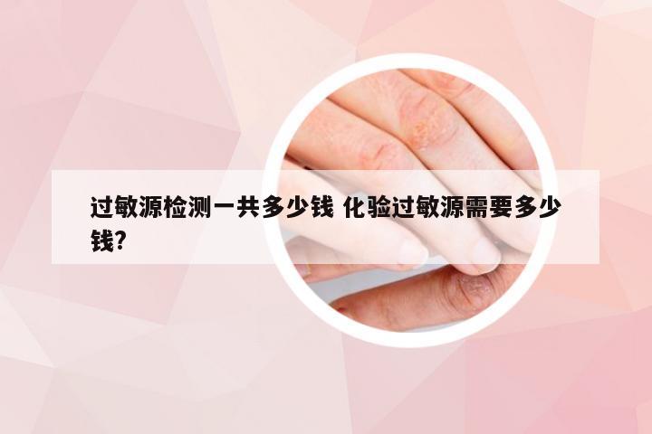 过敏源检测一共多少钱 化验过敏源需要多少钱?