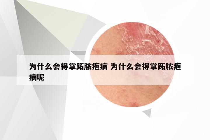 为什么会得掌跖脓疱病 为什么会得掌跖脓疱病呢