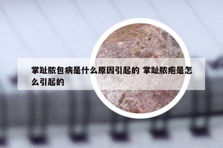 掌趾脓包病是什么原因引起的 掌趾脓疱是怎么引起的