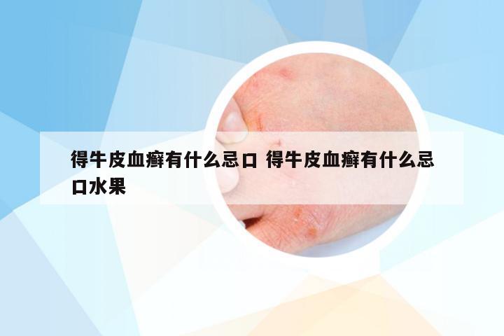 得牛皮血癣有什么忌口 得牛皮血癣有什么忌口水果
