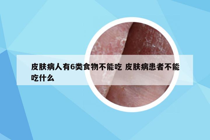 皮肤病人有6类食物不能吃 皮肤病患者不能吃什么