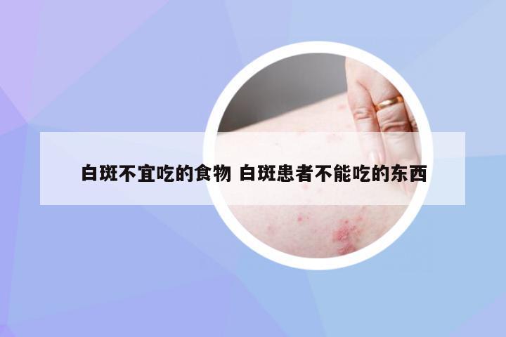白斑不宜吃的食物 白斑患者不能吃的东西
