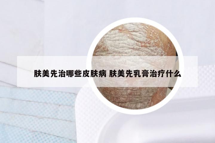肤美先治哪些皮肤病 肤美先乳膏治疗什么