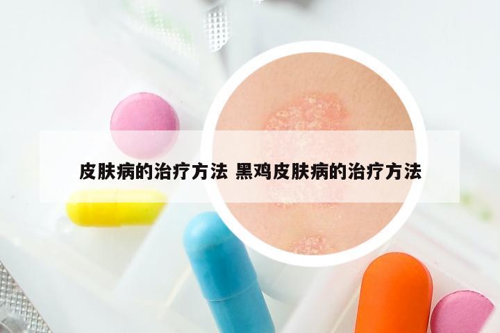 皮肤病的治疗方法 黑鸡皮肤病的治疗方法