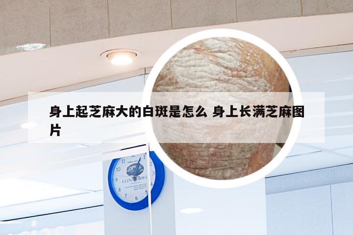 身上起芝麻大的白斑是怎么 身上长满芝麻图片