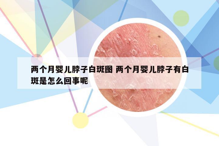 两个月婴儿脖子白斑图 两个月婴儿脖子有白斑是怎么回事呢