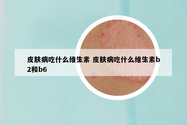 皮肤病吃什么维生素 皮肤病吃什么维生素b2和b6