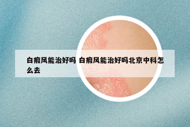 白瘕风能治好吗 白瘕风能治好吗北京中科怎么去