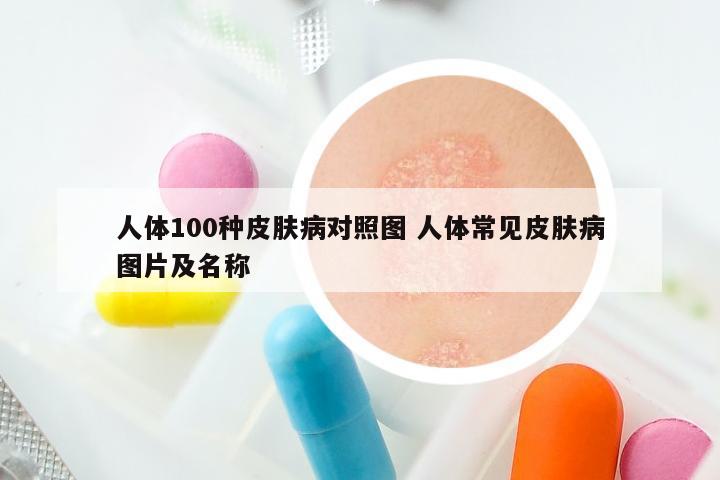 人体100种皮肤病对照图 人体常见皮肤病图片及名称