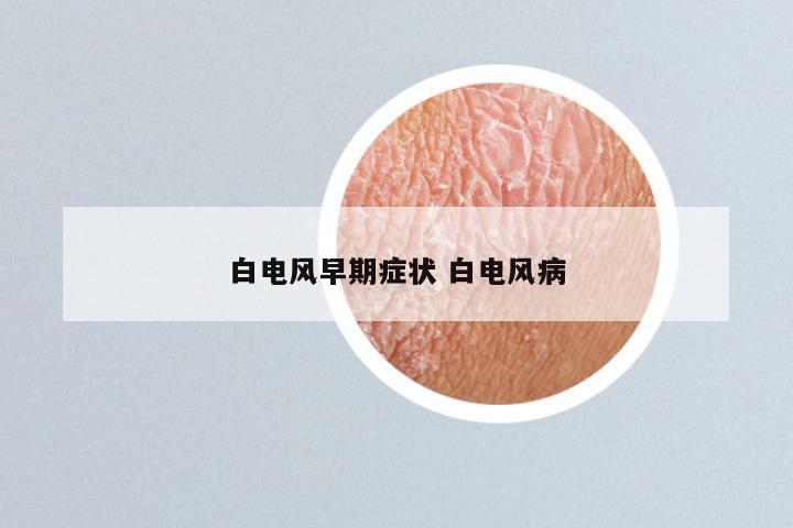 白电风早期症状 白电风病