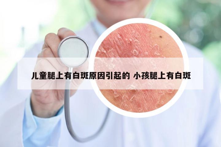 儿童腿上有白斑原因引起的 小孩腿上有白斑
