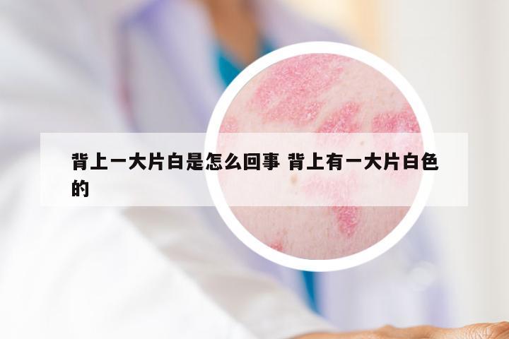 背上一大片白是怎么回事 背上有一大片白色的