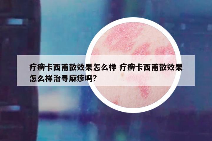 疗癣卡西甫散效果怎么样 疗癣卡西甫散效果怎么样治寻麻疹吗?