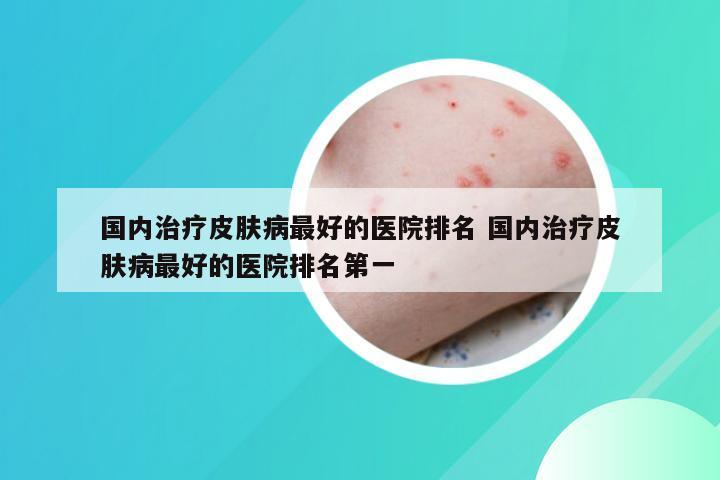 国内治疗皮肤病最好的医院排名 国内治疗皮肤病最好的医院排名第一