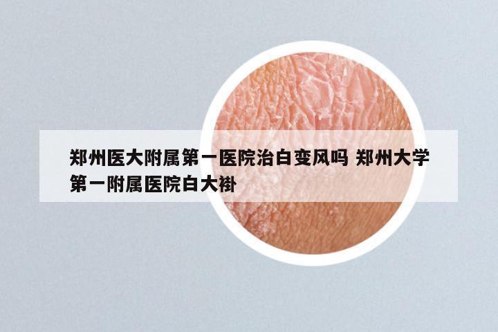 郑州医大附属第一医院治白变风吗 郑州大学第一附属医院白大褂